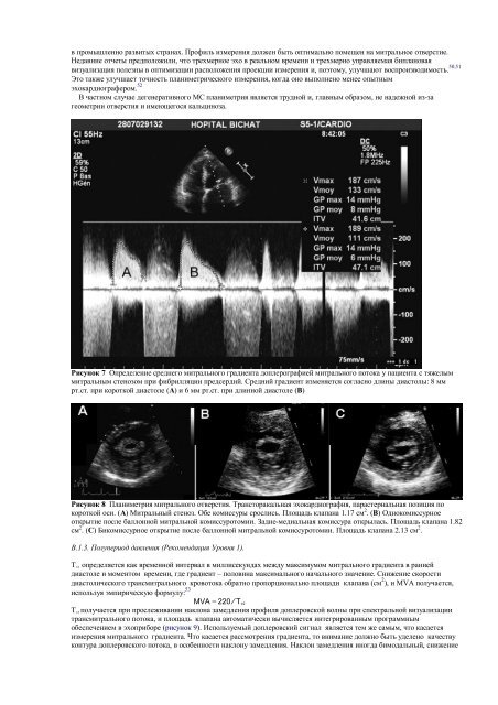 Echocardiographic Assessment of Valve Stenosis: EAE/ASE ...