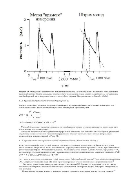 Echocardiographic Assessment of Valve Stenosis: EAE/ASE ...