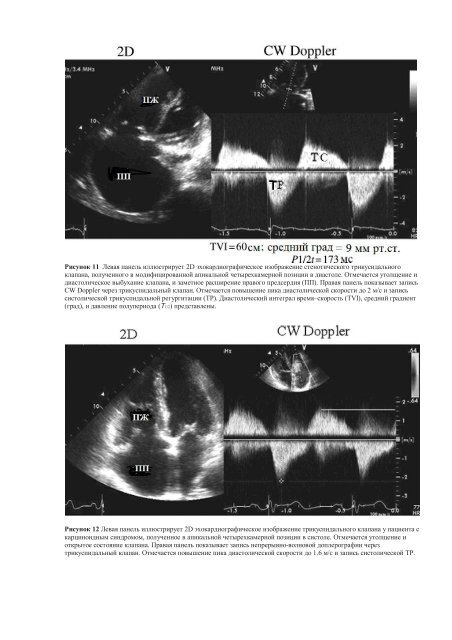 Echocardiographic Assessment of Valve Stenosis: EAE/ASE ...