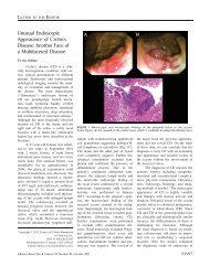 Unusual endoscopic appearance of Crohn's disease ... - Publicatio