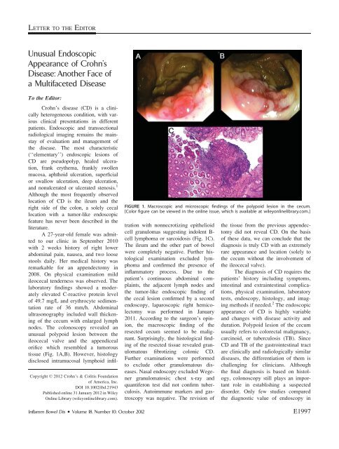 Unusual endoscopic appearance of Crohn's disease ... - Publicatio