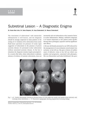 Subretinal Lesion – A Diagnostic Enigma - KSOS