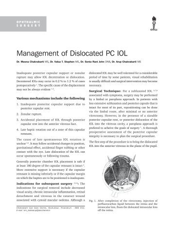 Management of Dislocated PC IOL - KSOS