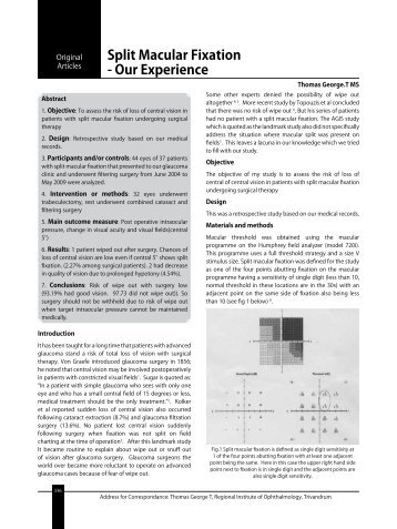 Split Macular Fixation - Our Experience - KSOS