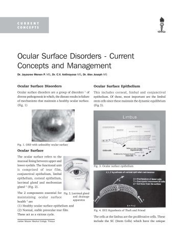 Ocular Surface Disorders - Current Concepts and ... - KSOS