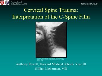 Cervical Spine Trauma: Interpretation on the C-Spine Film - Harvard ...