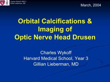 Orbital Calcifications & Imaging of Optic Nerve Head Drusen