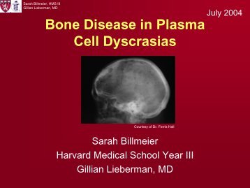 Bone Disease in Plasma Cell Dyscrasias