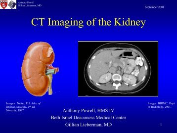 CT Imaging of the Kidney