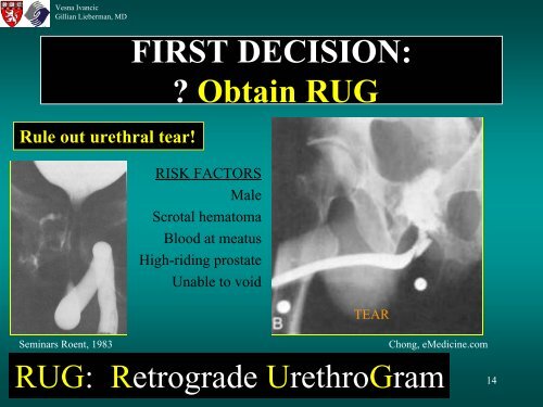 BLADDER RUPTURE