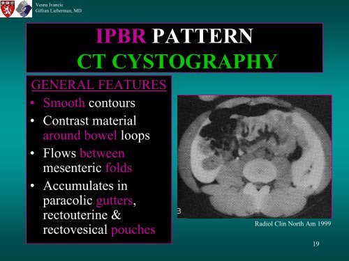 BLADDER RUPTURE