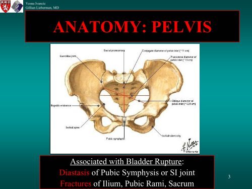 BLADDER RUPTURE