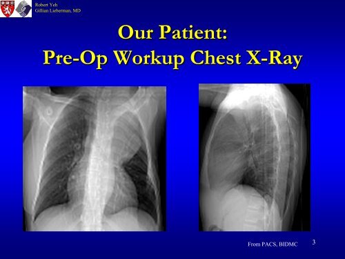 Case Presentation: An Atypical Mediastinal Mass