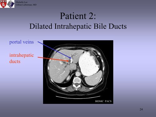 Radiologic Staging Of Pancreatic Cancer