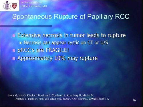 A52-Year-Old with Renal Mass / MR-Guided Focused Ultrasound