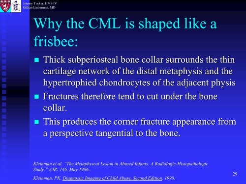 Metaphyseal and Rib Fractures in Child Abuse