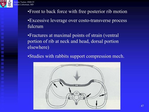 Metaphyseal and Rib Fractures in Child Abuse