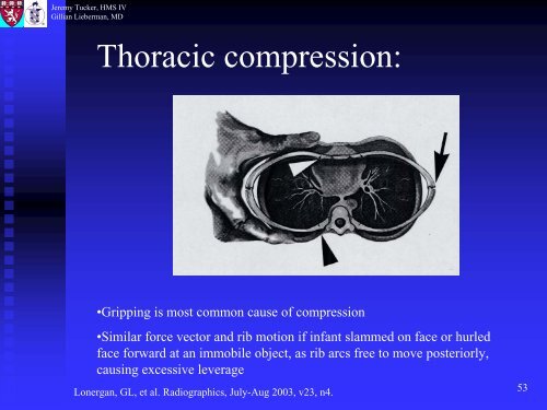 Metaphyseal and Rib Fractures in Child Abuse