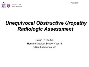 Unequivocal Obstructive Uropathy Radiologic Assessment