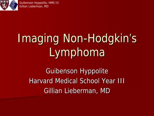 Imaging Non-Hodgkin's Lymphoma - Lieberman's eRadiology ...