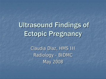 Ultrasound Findings of Ectopic Pregnancy