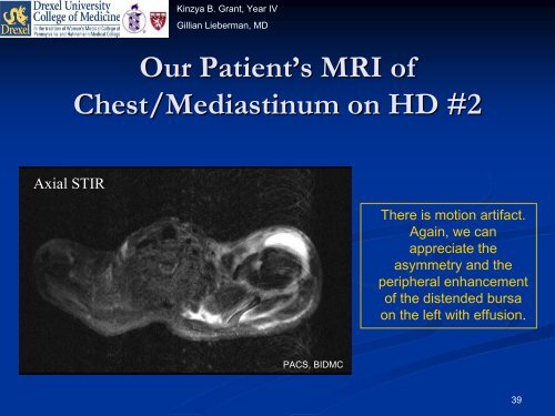 Indium-111 Leukocyte Scintigraphy - Lieberman's eRadiology ...