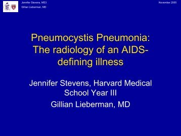 Pneumocystis Pneumonia: The radiology of an AIDS- defining illness