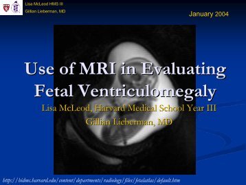 Use of MRI in Evaluating Fetal Ventriculomegaly