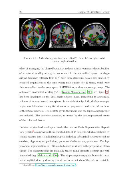 Docteur de l'université Automatic Segmentation and Shape Analysis ...