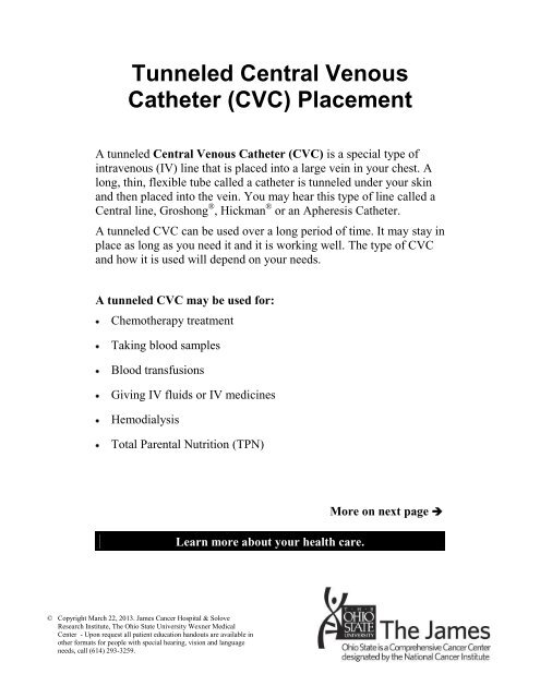 Tunneled Central Venous Catheter (CVC) Placement - Patient ...