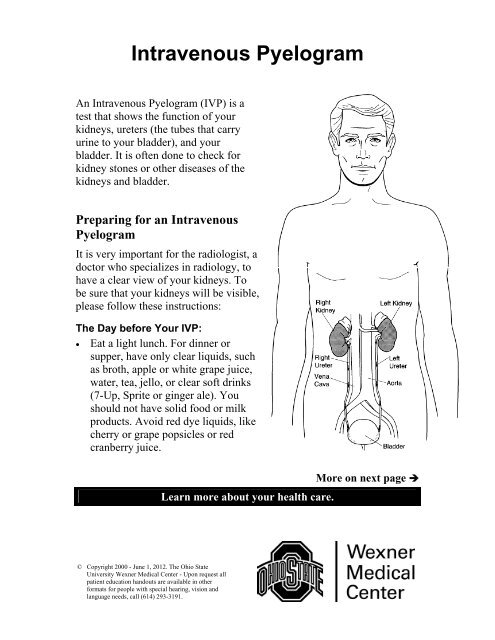 Intravenous Pyelogram - Patient Education Home