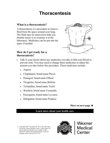 Thoracentesis - Patient Education Home