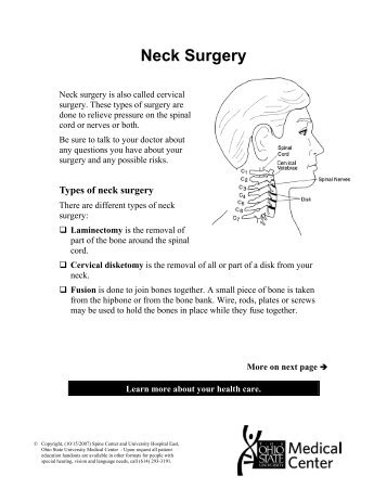 Your Neck Surgery - Patient Education Home