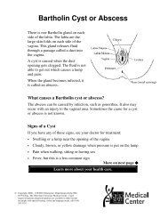 Bartholin Cyst or Abscess - Patient Education Home - The Ohio ...