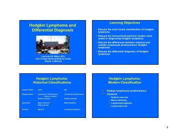 Hodgkin Lymphoma