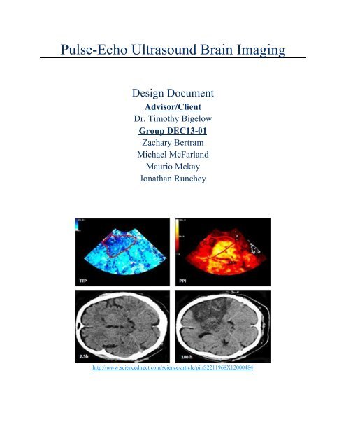 Pulse-Echo Ultrasound Brain Imaging - Senior Design