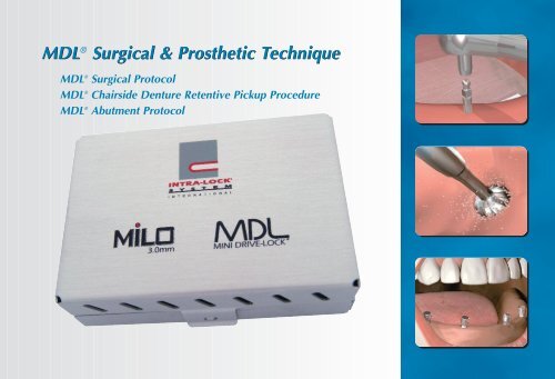 MDL® Surgical & Prosthetic Technique Manual - Intra-Lock