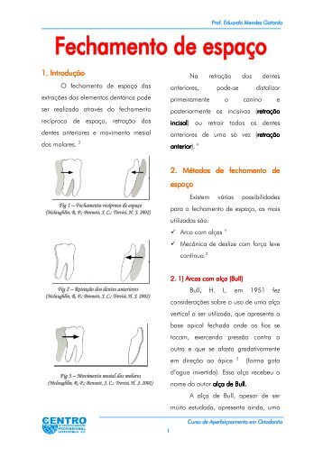 1. Introdução . Introdução . Introdução 2. Métodos de fechamento de ...