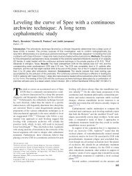 Leveling the curve of Spee with a continuous archwire technique: A ...