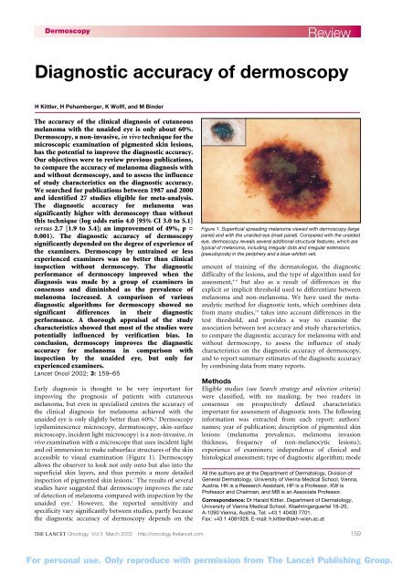 Diagnostic accuracy of dermoscopy - Dermatology