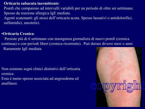 orticaria angioedema 2012 - Corso di laurea in tecniche della ...