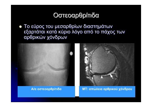 ΦΥΣΙΟ - ΓΟΝΑΤΟ - e-Class