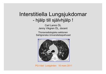 Interstitiella Lungsjukdomar