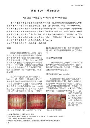 牙齦生物形態的探討 - 臺北榮民總醫院- 台北榮民總醫院