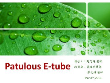 Patulous E-tube
