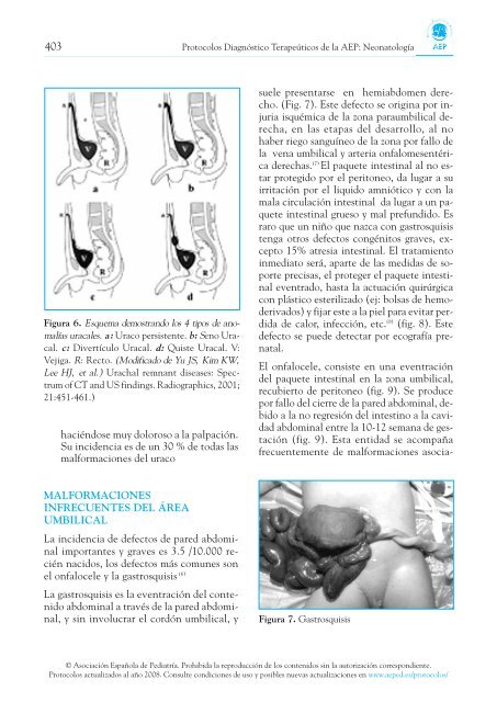 Patología Umbilical Frecuente - Asociación Española de Pediatría