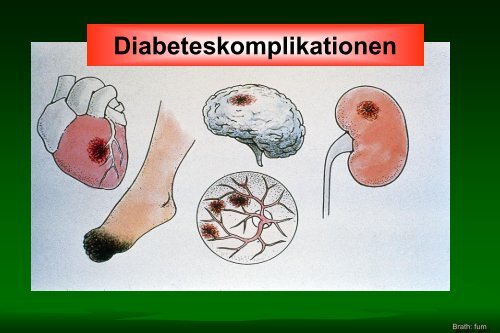 Rauchen und Diabetes