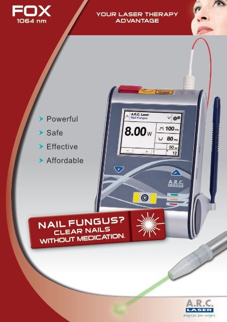 FOX III for nail fungus (PDF 2 9 - ARC Laser