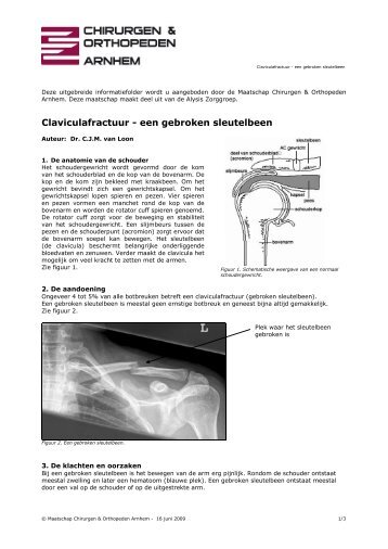 Claviculafractuur - een gebroken sleutelbeen - Website Chirurgen ...