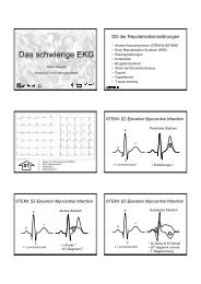 Das schwierige EKG